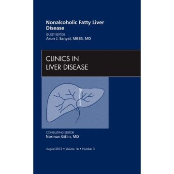 Nonalcoholic Fatty Liver Disease, An Issue of Clinics in Liver Disease   [Sanyal  - Elsevier Science]
