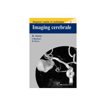 Sartor Imaging Cerebrale cic edizioni