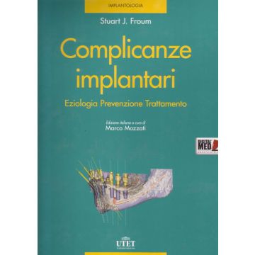 Complicanze Implantari - Eziologia Prevenzione Trattamento - Con DVD e Micro SD  [Froum Stuart - Utet]