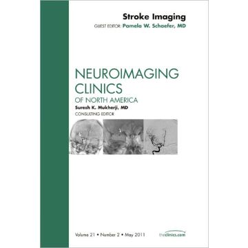 Stroke Imaging, An Issue of Neuroimaging Clinics