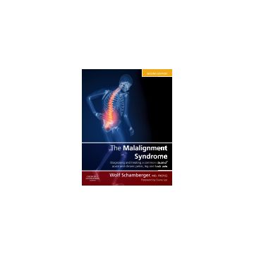 The Malalignment Syndrome, 2nd Edition - Diagnosis and treatment of common pelvic and back pain   [Schamberger  - Elsevier Science]