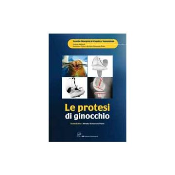 Le Protesi di Ginocchio