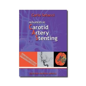 Advances in Carotid Artery Stenting   [Setacci - Minerva Medica]