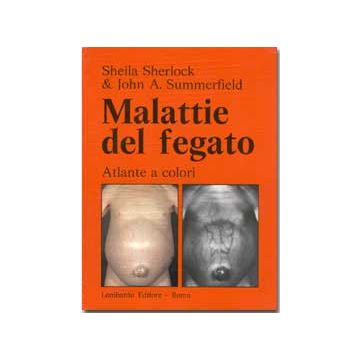 Malattie del fegato - Atlante a colori