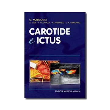 Carotide e ictus