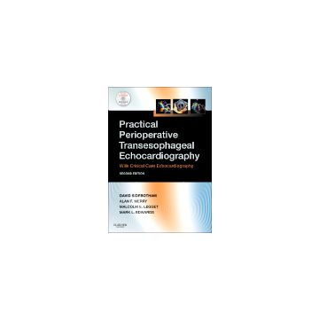 Practical Perioperative Transesophageal Echocardiography, 2nd Edition - Text with DVD-ROM