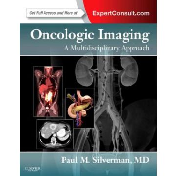 Oncologic Imaging: A Multidisciplinary Approach - EXPERT CONSULT - ONLINE AND PRINT   [Silverman  - Elsevier Science]