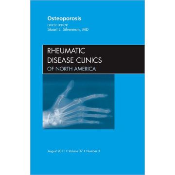 Osteoporosis, An Issue of Rheumatic Disease Clinics