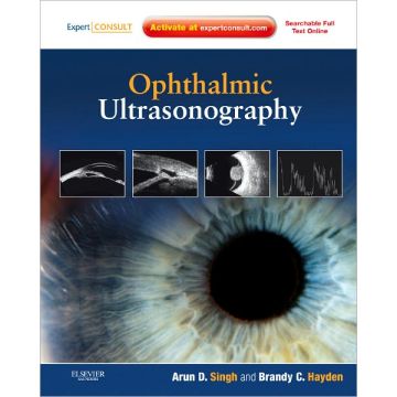 Ophthalmic Ultrasonography - EXPERT CONSULT - ONLINE AND PRINT  [Singh  - ELSEVIER SCIENCE]