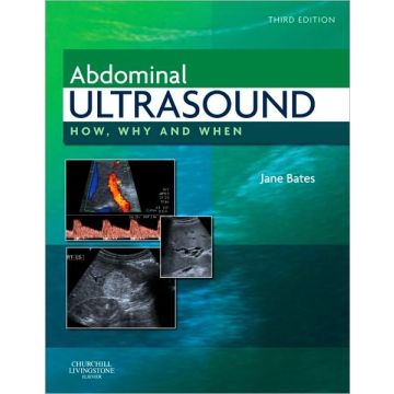 Abdominal Ultrasound, 3rd Edition - HOW, WHY AND WHEN