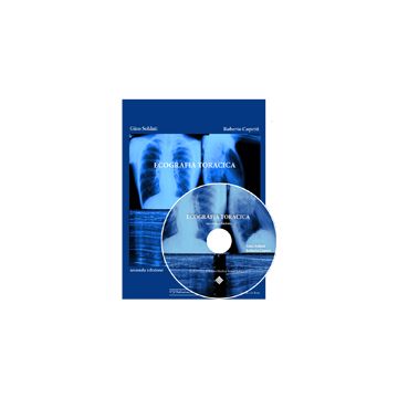 Ecografia Toracica  2/Ed.    [Soldati  - CG Edizioni Medico Scientifiche]