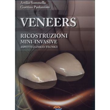 Veneers ricostruzioni mini-invasive. Aspetti clinico tecnici (Le faccette) [Sommella; Paoloantoni - Teamwork Medica]