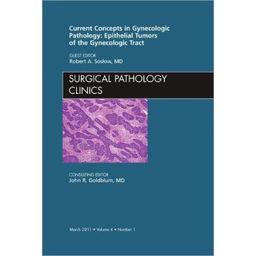 Current Concepts in Gynecologic Pathology: Epithelial Tumors of the Gynecologic Tract, An Issue of Surgical Pathology Clinics   [Soslow  - Elsevier Science]