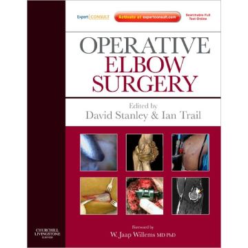 Operative Elbow Surgery - Expert Consult: Online and Print 