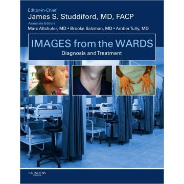 Images from the Wards: Diagnosis and Treatment