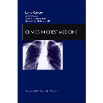 Lung Cancer, An Issue of Clinics in Chest Medicine  [Tanoue - Elsevier Science]