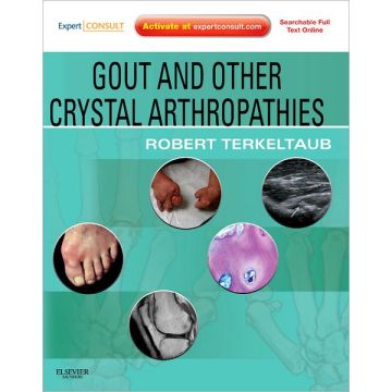 Gout & Other Crystal Arthropathies - EXPERT CONSULT: ONLINE AND PRINT