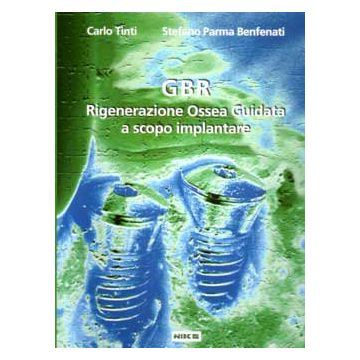 GBR Rigenerazione Ossea Guidata a scopo Implantare  [Tinti - Nike Edizioni]