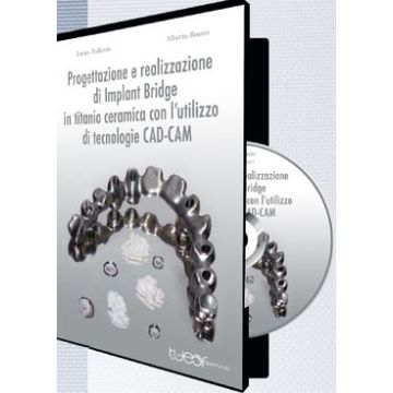 Progettazione e Realizzazione di Implant Bridge in Titanio Ceramica con l'utilizzo di Tecnologie CAD-CAM - DVD ROM [Tollardo - TUEOR]
