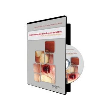 Il trattamento dell'alveolo post-estrattivo. Tecniche di estrazione dentaria DVD  Mozzati Marco; Mela Luca; Arata Valentina  Turin Editorial Organization TU.E.OR  
