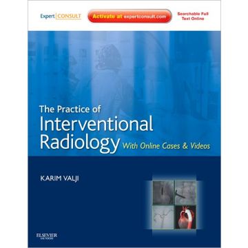 The Practice of Interventional Radiology, with online cases and video - EXPERT CONSULT PREMIUM EDITION - ENHANCED ONLINE FEATURES AND PRINT