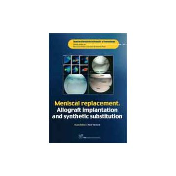 Meniscal Replacement - Allograft Implantation and Synthetic Substitution  [Verdonk- CIC Edizioni Internazionali]