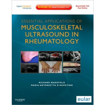 Essential Applications of Musculoskeletal Ultrasound in Rheumatology - EXPERT CONSULT PREMIUM EDITION: ENHANCED ONLINE FEATURES AND PRINT