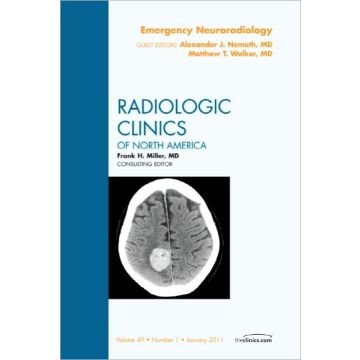 Emergency Neuroradiology, An Issue of Radiologic Clinics of North America