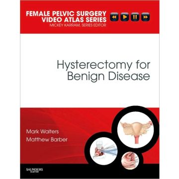 Hysterectomy for Benign Disease - Female Pelvic Surgery Video Atlas Series