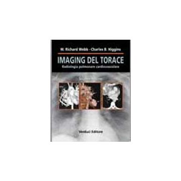 IMAGING DEL TORACE. Radiologia Polmonare e Cardiovascolare 2/ed. [Webb; Higgins - Verduci Editore]