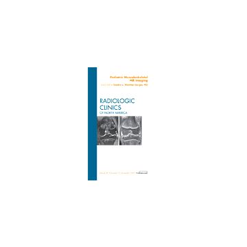 Pediatric Musculoskeletal MR Imaging, An Issue of Radiologic Clinics of North America Volume 47-6