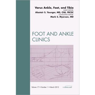 Varus Foot, Ankle, and Tibia, An Issue of Foot and Ankle Clinics   [Younger  - Elsevier Science]