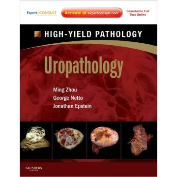 Uropathology - A VOLUME IN THE HIGH YIELD PATHOLOGY SERIES (EXPERT CONSULT - ONLINE AND PRINT)   [Zhou  - Elsevier Science]