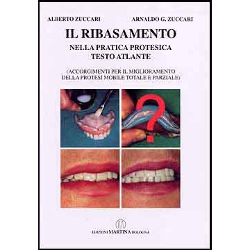 Il Ribasamento - nella pratica protesica - Testo Atlante