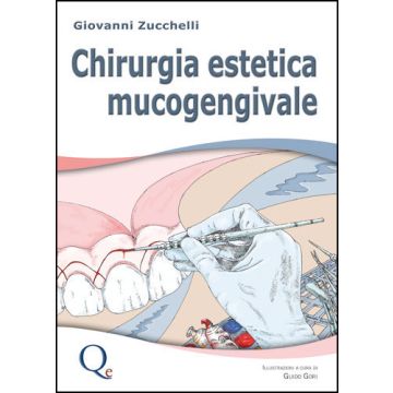 Chirurgia Estetica Mucogengivale Zucchelli Giovanni quintessenza edizioni