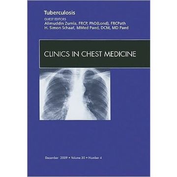 Tuberculosis, An Issue of Clinics in Chest Medicine Volume 30-4